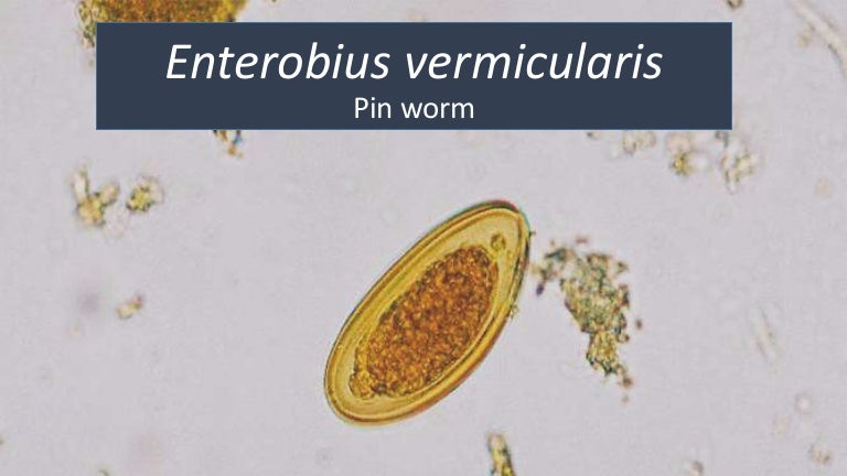 enterobius vermicularis slideshare)