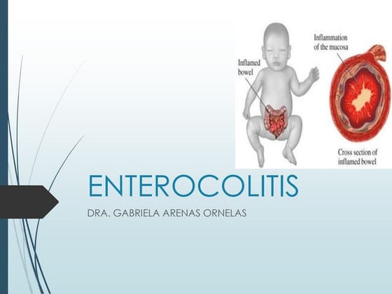 Diagnostico y tratamiento deshidratacion | PPT