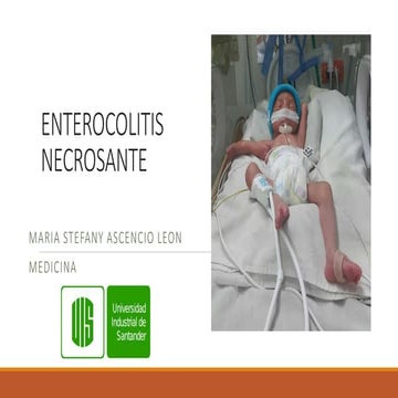 Enterocolitis necrosante 