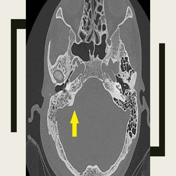 EAR NOSE THROAT BASIC RADIOLOGICAL INTERPRETATION RADIOLOGY.pptx
