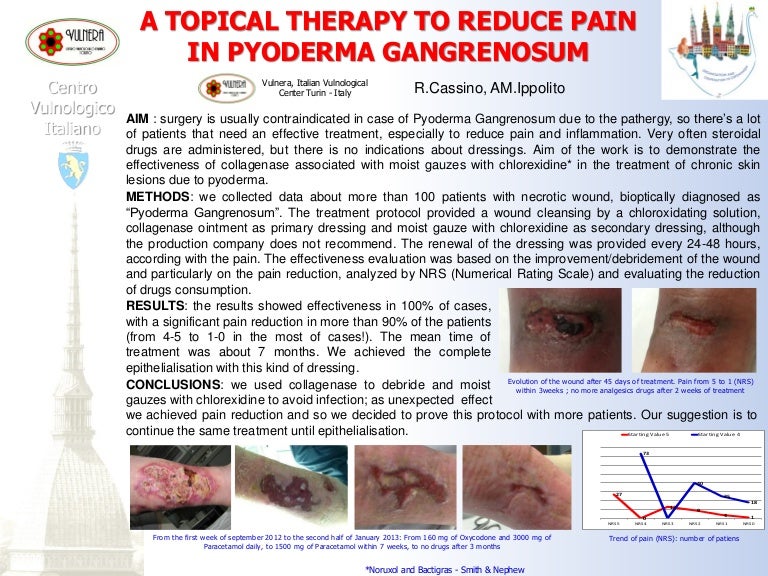 EWMA 2013 Ep530 A TOPICAL THERAPY TO REDUCE PAIN IN PYODERMA GANG…
