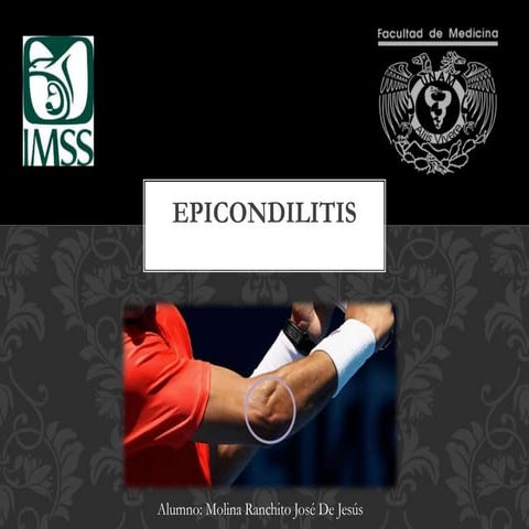 Epicondilitis y-epitrocleitis