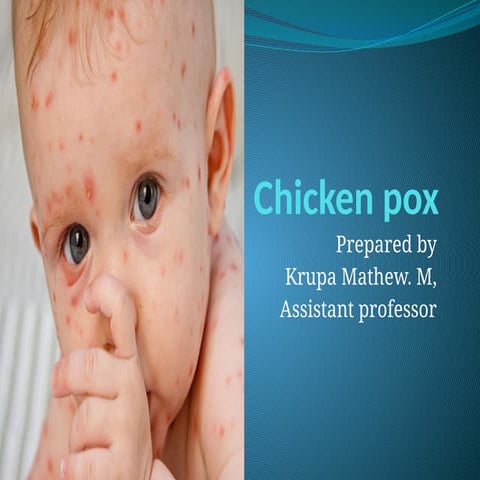Epidemiology of Chicken pox.pptx...................