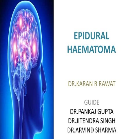 Epidural haematoma extradural haemorrhage