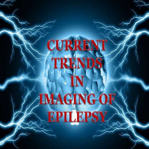 Current trends in imaging of Epilepsy