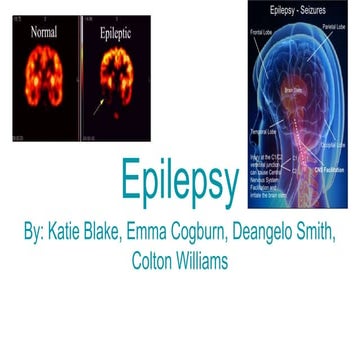 Epilepsy