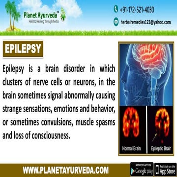 Ayurvedic treatment for Epilepsy | Herbal Remedies for Seizures