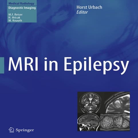 Epilepsy mri
