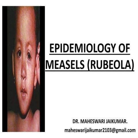 EPIDEMIOLOGY OF MEASELS
