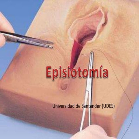 Episiotomía