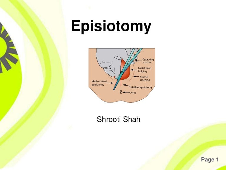 Episiotomy