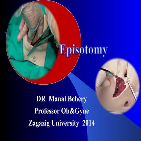Episotomy for undergraduate