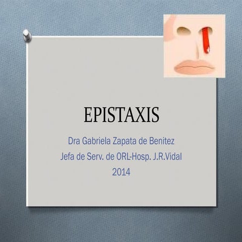 Epistaxis