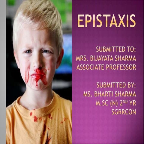 Epistaxis and its surgical and nursing management