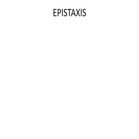 EPISTAXIS.pptx