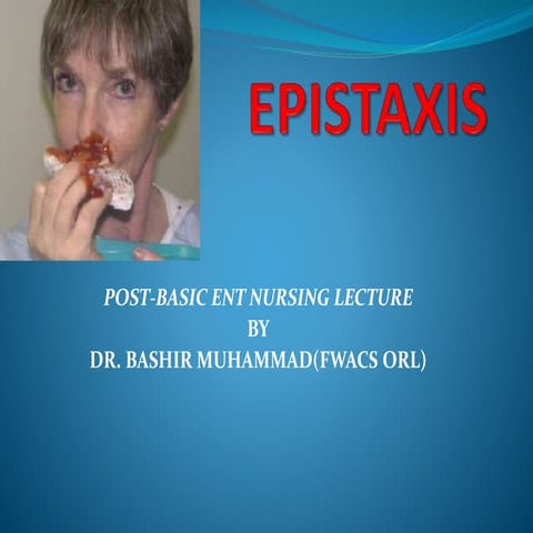 EPISTAXIS