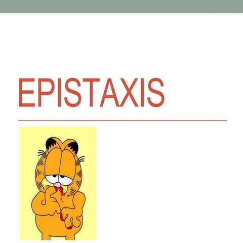 epistaxis.pptx