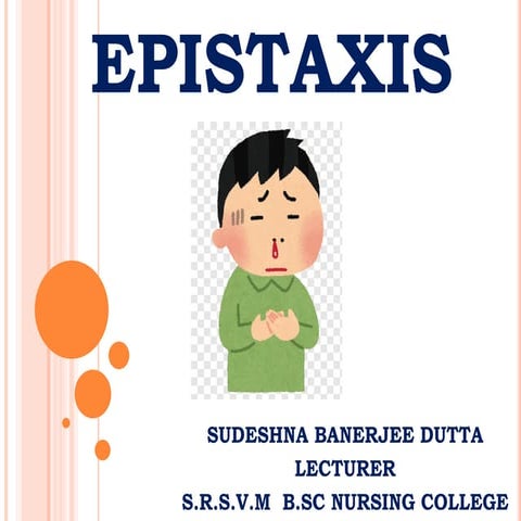 Epistaxis 