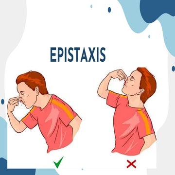 EPISTAXIS BASE DEL LIBRO DO DR DFD(1).pdf