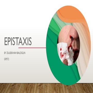 Epistaxis ( Nose Bleeding ) .ppt