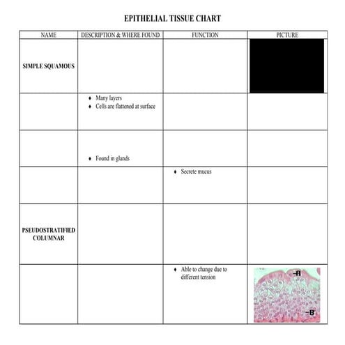 Epithelial chart & 4 tissue review
