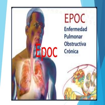 Epoc | PPTX