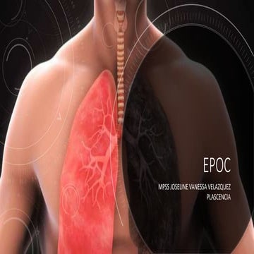 Epoc | PPTX