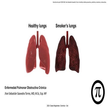 El diagnóstico de la EPOC: 2025-  combinación variable de enfisema y bronquit...