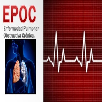 Epoc explicado al 100  5 C 