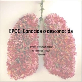 Epo cconocida desconocida