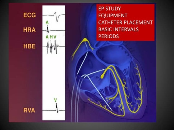 Cath lab | PPTX