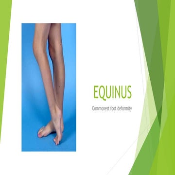 Equinus