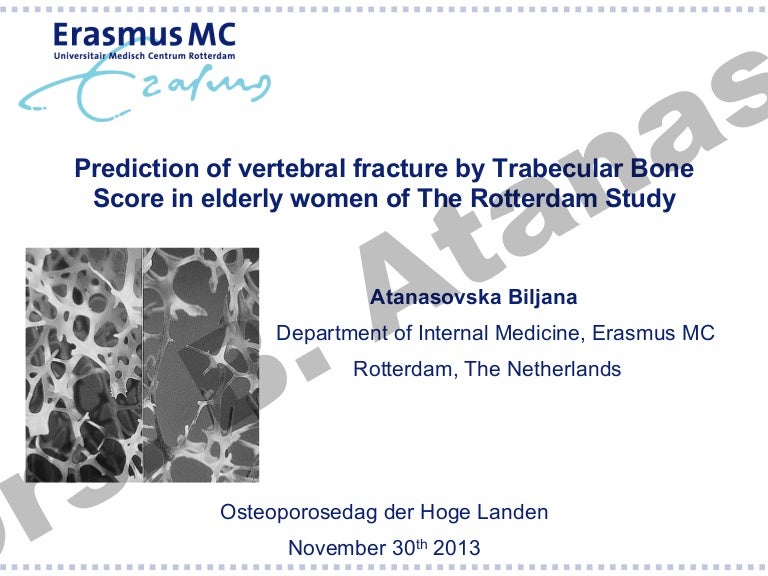 Seminar 30-11-2013 - Prediction of vertebral fracture
