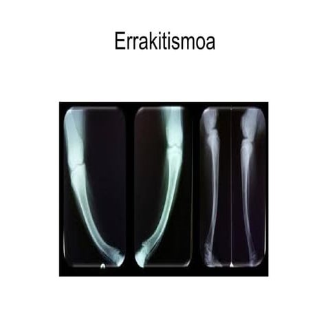 Errakitismoa iker palacios