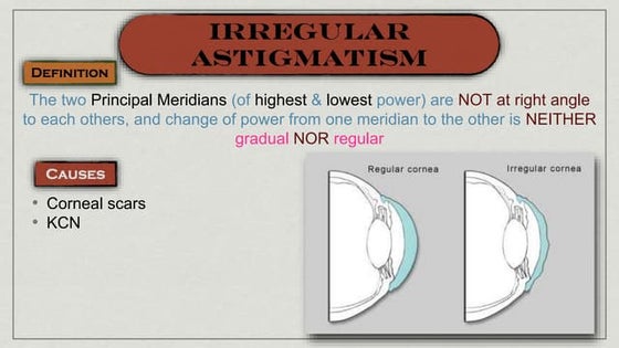Open Angle Glaucoma Treatment Guidelines Astigmatism 2ry Angle Closure