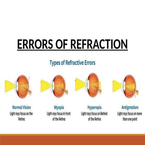 Refractive errors (eye condions) | PPTX