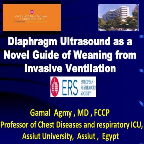 Diaphragm Ultrasound as a Novel Guide of Weaning from Invasive Ventilation
