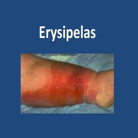 Erysipelas