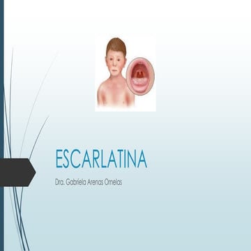 Escarlatina