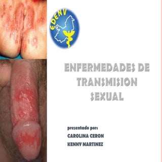 enfermedades de transmisión sexual 