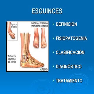 esguinces