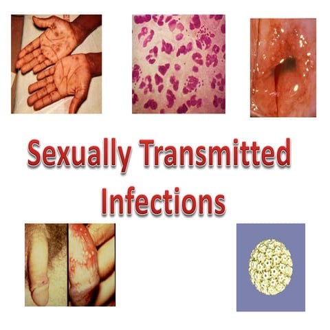 Pathology of STD - Sexually Transmitted Disorders | PPTX