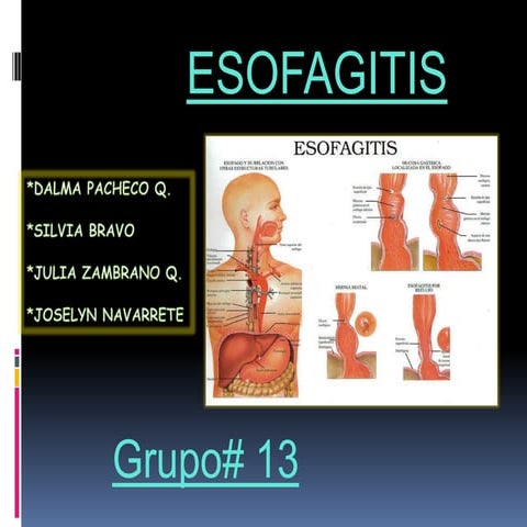 ESOFAGITIS INFECCIOSA | PDF