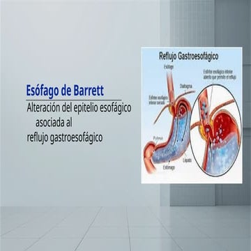 esofago_de_barrett[1].pptxUHCRUBVUIREBVUIREBVUIRBV | PPTX