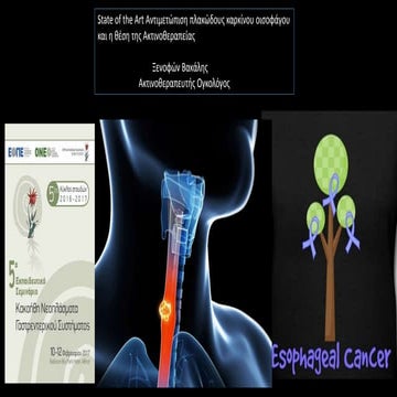 Esophageal squamous Cancer-therapy-Vakalis