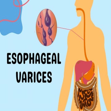 Esophageal-Varices-20250317_123341_0000.pdf