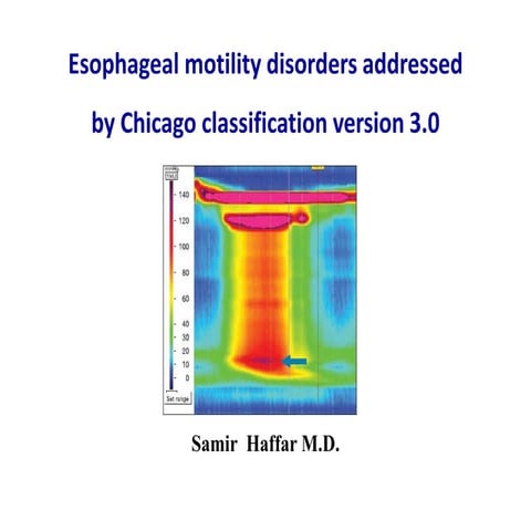 Esophageal motility disorders in Chicago classification v3.0