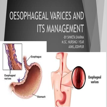 Esophageal varices