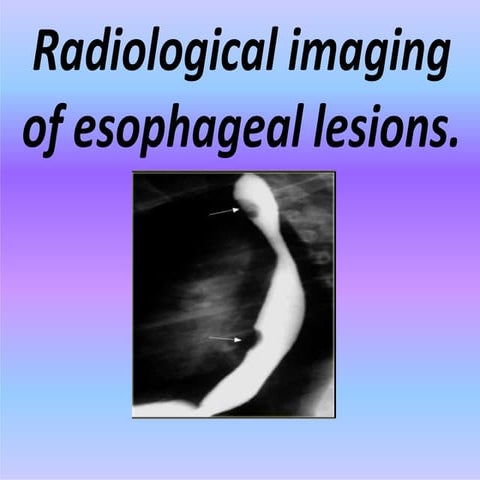 esophagus 2.pptx