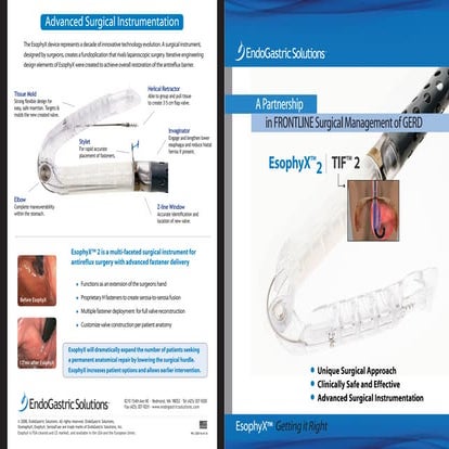 Esophyx physician-brochure | PPT